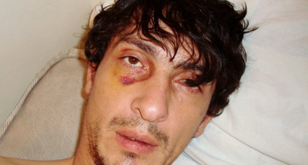 Ismail Tsechoev in the Central Republic's Hospital in Nazran, early December 2011. Courtesy of Ismail Tsechoev's relatives