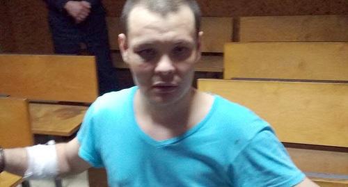 Timur Muritov with traces of beatings, April 2018. Photo by advocate Israfil Gadadov for the Caucasian Knot