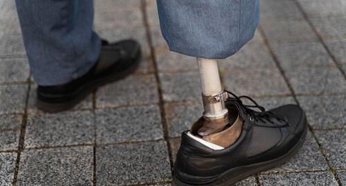 A disabled person. Photo: ru.freepik.com/photos/woman'>Woman photo created by freepik - ru.freepik.com