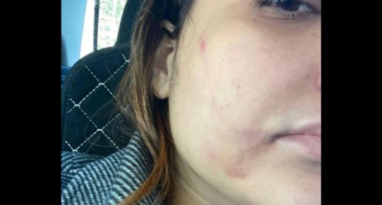 A female lawyer in Rostov-on-Don after being attacked, photo: https://t.me/astrapress/62169 A female lawyer in Rostov-on-Don after being attacked, photo: https://t.me/astrapress/62169