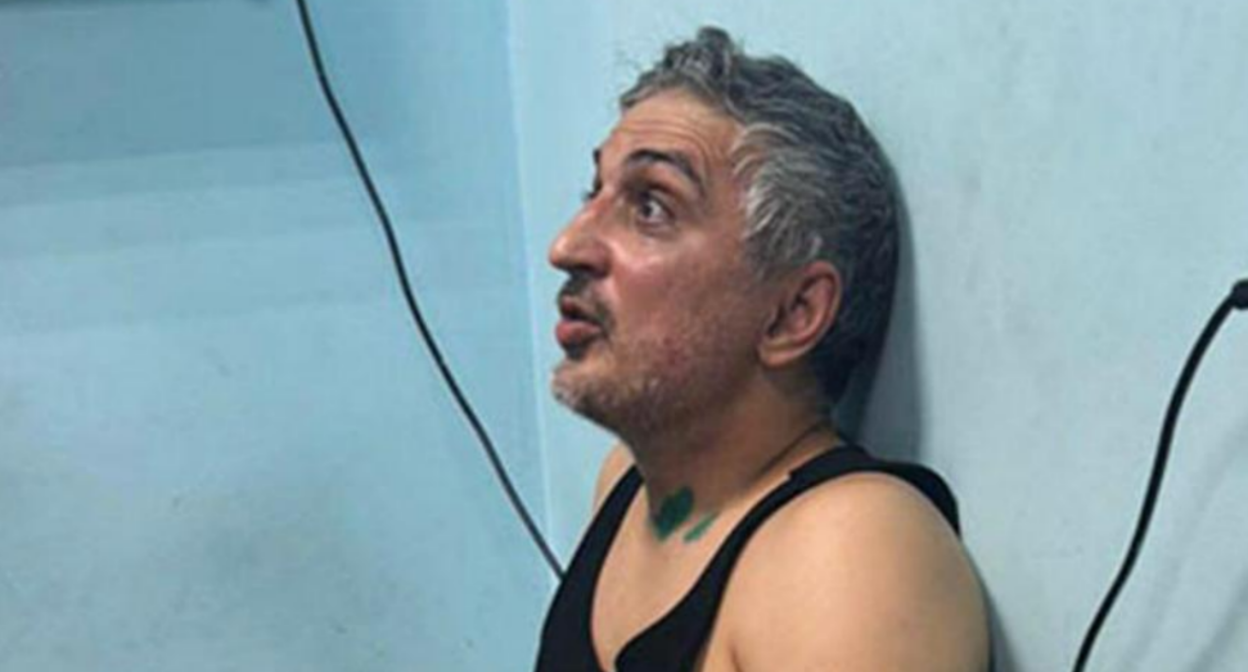 Zaur Kaituev after the beating. Photo courtesy of the "Caucasian Knot."