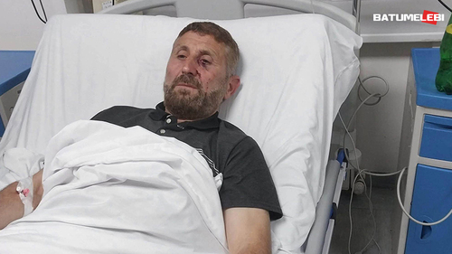 In Akhaltsikhe, in the yard of his father's house, the imam of the local mosque, Shevket Dvalidze, was beaten. Photo: Batumelebi / https://batumelebi.netgazeti.ge/news/629810/ In Akhaltsikhe, in the yard of his father's house, the imam of the local mosque, Shevket Dvalidze, was beaten. Photo: Batumelebi / https://batumelebi.netgazeti.ge/news/629810/